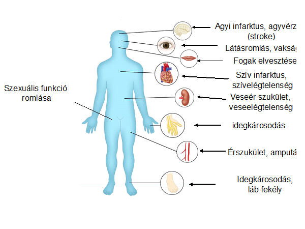 ginger diabetes kezelésére 2 mi szükséges a cukorbetegség kezeléséhez